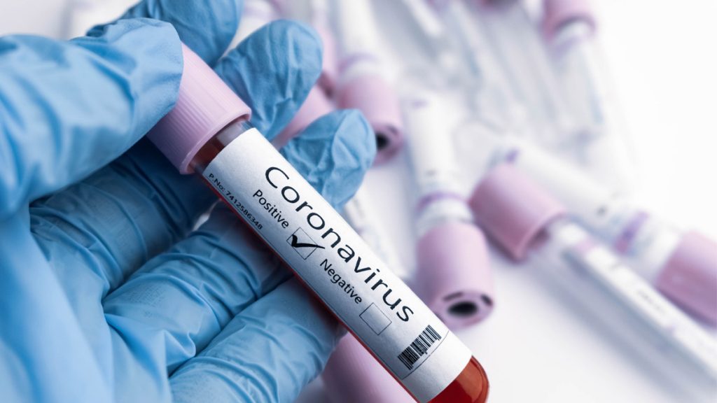 Saint Lucia records 20 new cases of COVID-19